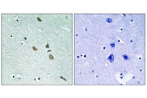 Immunohistochemistry analysis of paraffin-embedded human brain tissue using ILK (epitope around residue 246) antibody.