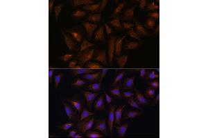 Immunofluorescence analysis of U-2 OS cells using CRYZ Rabbit pAb  at dilution of 1:100 (40x lens). (CRYZ anticorps  (AA 1-329))