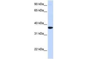 Image no. 1 for anti-Secretagogin, EF-Hand Calcium Binding Protein (SCGN) (AA 180-229) antibody (ABIN6743096) (SCGN anticorps  (AA 180-229))