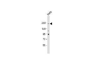 Anti-NOTCH3 Antibody at 1:2000 dilution + Hela whole cell lysate Lysates/proteins at 20 μg per lane.