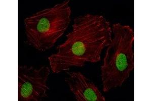 Fluorescent image of HUVEC cells stained with ISL2 antibody.