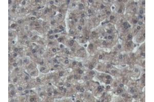 IHC-P analysis of Pig Liver Tissue, with DAB staining. (IGFBP4 anticorps  (AA 23-259))