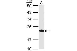 WB Image Sample (30 ug of whole cell lysate) A: Raji 12% SDS PAGE CKLFSF5 antibody antibody diluted at 1:500