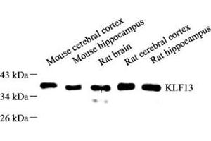 Western blot analysis of KLF13 (ABIN7074445) at dilution of 1: 500 (KLF13 anticorps)