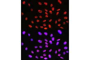 Immunofluorescence analysis of U-2 OS cells using KLF4 Rabbit mAb (ABIN7268157) at dilution of 1:100 (40x lens).