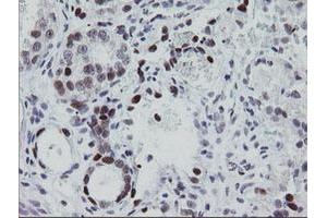 Image no. 1 for anti-Early Growth Response 2 (EGR2) (AA 156-476) antibody (ABIN1490982) (EGR2 anticorps  (AA 156-476))