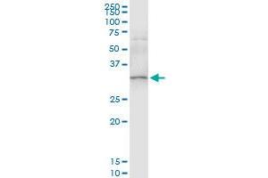 Immunoprecipitation of SULT1A1 transfected lysate using anti-SULT1A1 MaxPab rabbit polyclonal antibody and Protein A Magnetic Bead , and immunoblotted with SULT1A1 purified MaxPab mouse polyclonal antibody (B01P) .