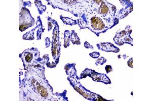 IHC analysis of Hemoglobin using anti-Hemoglobin antibody (ABIN5518839).