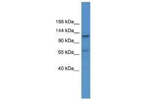 WB Suggested Anti-ERC1 Antibody Titration: 0. (ERC1 anticorps  (C-Term))