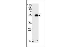 Western blot analysis of TP53(arrow) using rabbit polyclonal p53 Antibdoy (S15) (ABIN390201 and ABIN2840688).