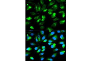 Immunofluorescence analysis of HeLa cells using ARHGDIA antibody. (ARHGDIA anticorps  (AA 1-204))