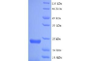 SDS-PAGE (SDS) image for Gen Endonuclease Homolog 1 (GEN1) (AA 1-183), (full length) protein (His tag) (ABIN5713720) (GEN1 Protein (AA 1-183, full length) (His tag))