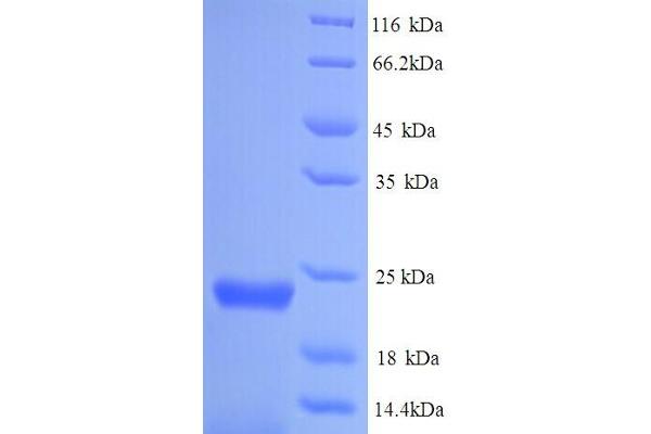 GEN1 Protein (AA 1-183, full length) (His tag)