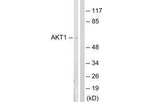 Western blot analysis of extracts from NIH/3T3cells, treated with PDGF (50 mg /mL, 20 mins), using Akt (Ab-124) antibody. (AKT1 anticorps  (Ser124))