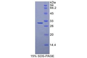 SDS-PAGE (SDS) image for alpha-2-Macroglobulin (A2M) (AA 1097-1357) protein (His tag,GST tag) (ABIN1878957)