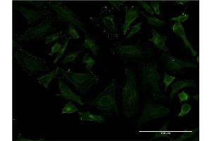 Immunofluorescence of monoclonal antibody to LRRN1 on HeLa cell. (LRRN1 anticorps  (AA 1-716))