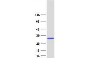 Validation with Western Blot