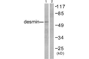 Western blot analysis of extracts from K562 cells, using Desmin antibody. (Desmin anticorps  (C-Term))