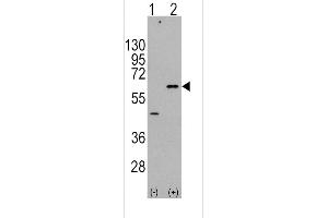 Western blot analysis of AKT3 (arrow) using rabbit polyclonal AKT3 Antibody  (ABIN391027 and ABIN2841197).