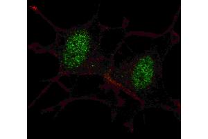 Fluorescent confocal ige of SY5Y cells stained with SD2 antibody. (SMAD2 anticorps  (AA 97-125))