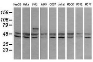 Image no. 7 for anti-Ring Finger Protein 39 (RNF39) antibody (ABIN1500723)