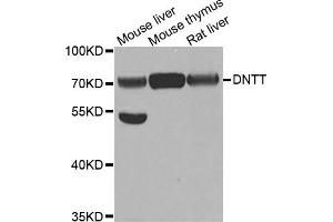Western Blotting (WB) image for anti-Deoxynucleotidyltransferase, terminal (DNTT) antibody (ABIN1882380) (TdT anticorps)