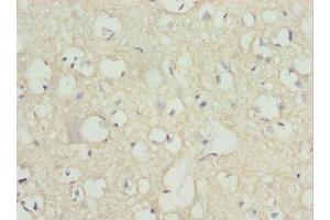Immunohistochemistry of paraffin-embedded human brain tissue using ABIN7162977 at dilution of 1:100 (PEX14 anticorps  (AA 118-377))