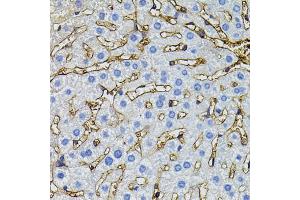 Immunohistochemistry of paraffin-embedded mouse liver using CBL antibody (ABIN5995395) (40x lens). (CBL anticorps)