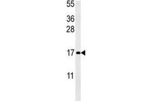 CCL4 antibody western blot analysis in mouse bladder tissue lysate (15ug/lane). (CCL4 anticorps  (AA 22-48))