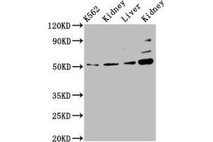 Western Blot Positive WB detected in: K562 whole cell lysate, Rat kidney tissue, Mouse liver tissue, Mouse kidney tissue All lanes: GSS antibody at 5. (Glutathione Synthetase anticorps  (AA 290-418))