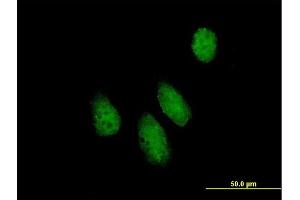 Immunofluorescence of purified MaxPab antibody to NUPL1 on HeLa cell. (NUPL1 anticorps  (AA 1-599))