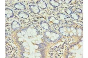 Immunohistochemistry of paraffin-embedded human small intestine tissue using ABIN7148128 at dilution of 1:100 (CCDC57 anticorps  (AA 1-300))