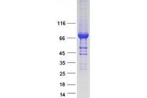 Validation with Western Blot
