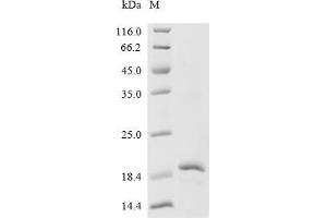 Sphingosine-1-Phosphate Receptor 5 (S1PR5) (AA 310-400) protein (His tag,MYC tag)