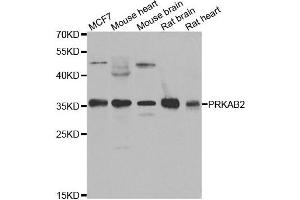 Western blot analysis of extracts of various cell lines, using PRKAB2 antibody. (PRKAB2 anticorps)