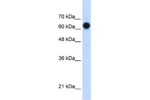 WB Suggested Anti-C3orf39 Antibody Titration:  1. (C3orf39 anticorps  (Middle Region))