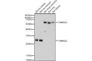 Western blot analysis of extracts of various cell lines, using TMPRSS2 antibody (ABIN6132728, ABIN6149286, ABIN6149287 and ABIN6219138) at 1:1000 dilution.