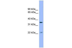 WB Suggested Anti-ZDHHC21 Antibody Titration: 0. (ZDHHC21 anticorps  (Middle Region))