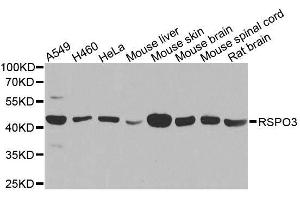 Western blot analysis of extracts of various cell lines, using RSPO3 antibody. (R-Spondin 3 anticorps  (AA 1-100))