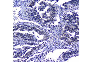 IHC analysis of MAX using anti-MAX antibody .