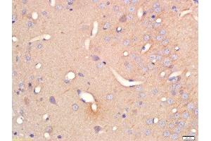 Formalin-fixed and paraffin embedded rat brain labeled with Anti-Serine Racemase Polyclonal Antibody, Unconjugated  at 1:200 followed by conjugation to the secondary antibody and DAB staining (SRR anticorps  (AA 1-100))