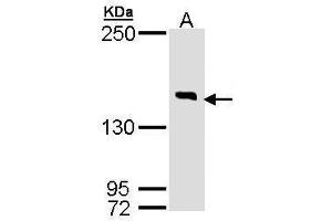 WB Image Sample (30 ug of whole cell lysate) A: Hela 7. (DIP2B anticorps  (C-Term))