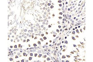 Immunohistochemistry analysis of paraffin-embedded Rat testis using NFKBIB Polyclonal Antibody at dilution of 1:300. (NFKBIB anticorps)