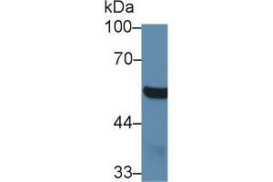 Western Blot; Sample: Mouse Cerebrum lysate; Primary Ab: 1µg/ml Rabbit Anti-Mouse ABAT Antibody Second Ab: 0.
