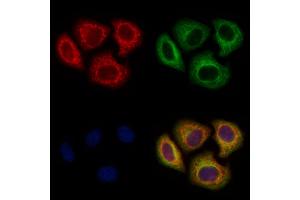 ABIN6265879 and ABIN6278541 staining Hela cells by IF/ICC.