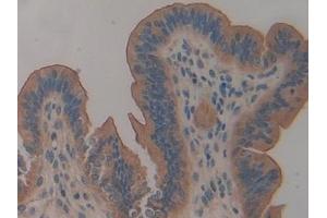 Detection of MUC1 in Mouse Uterus Tissue using Polyclonal Antibody to Mucin 1 (MUC1)