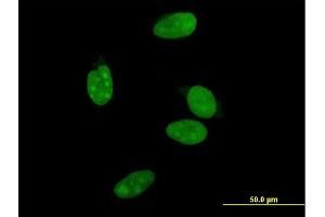 Immunofluorescence of monoclonal antibody to NR0B2 on HeLa cell. (NR0B2 anticorps  (AA 1-257))