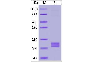 Biotinylated Human PD-L1 (19-134), His,Avitag on  under reducing (R) condition.