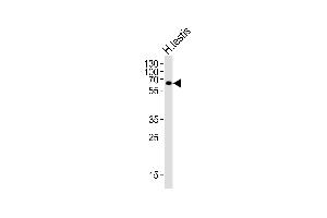Western blot analysis of lysate from human testis tissue lysate, using ZIM2 Antibody (N-term) (ABIN6244190 and ABIN6577604). (ZIM2 anticorps  (N-Term))