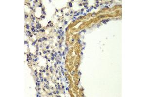 Immunohistochemistry (IHC) image for anti-Protein Kinase, CGMP-Dependent, Type I (PRKG1) (AA 1-300) antibody (ABIN3016256) (PRKG1 anticorps  (AA 1-300))